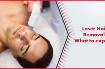 Laser Hair Removal in